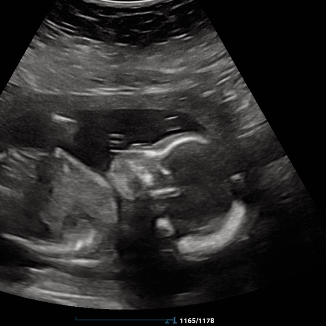 Photo shared by Bree for their Babylist baby registry.