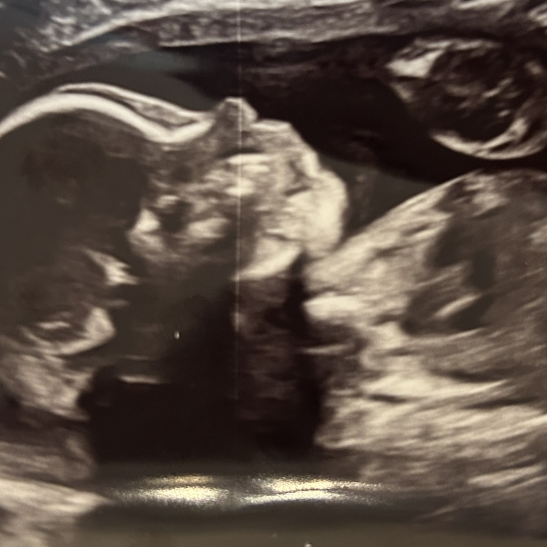 Photo shared by Holly for their Babylist baby registry.