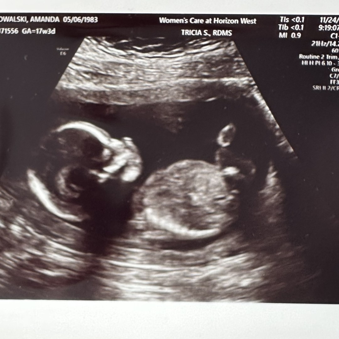 Photo shared by Mandy for their Babylist baby registry.
