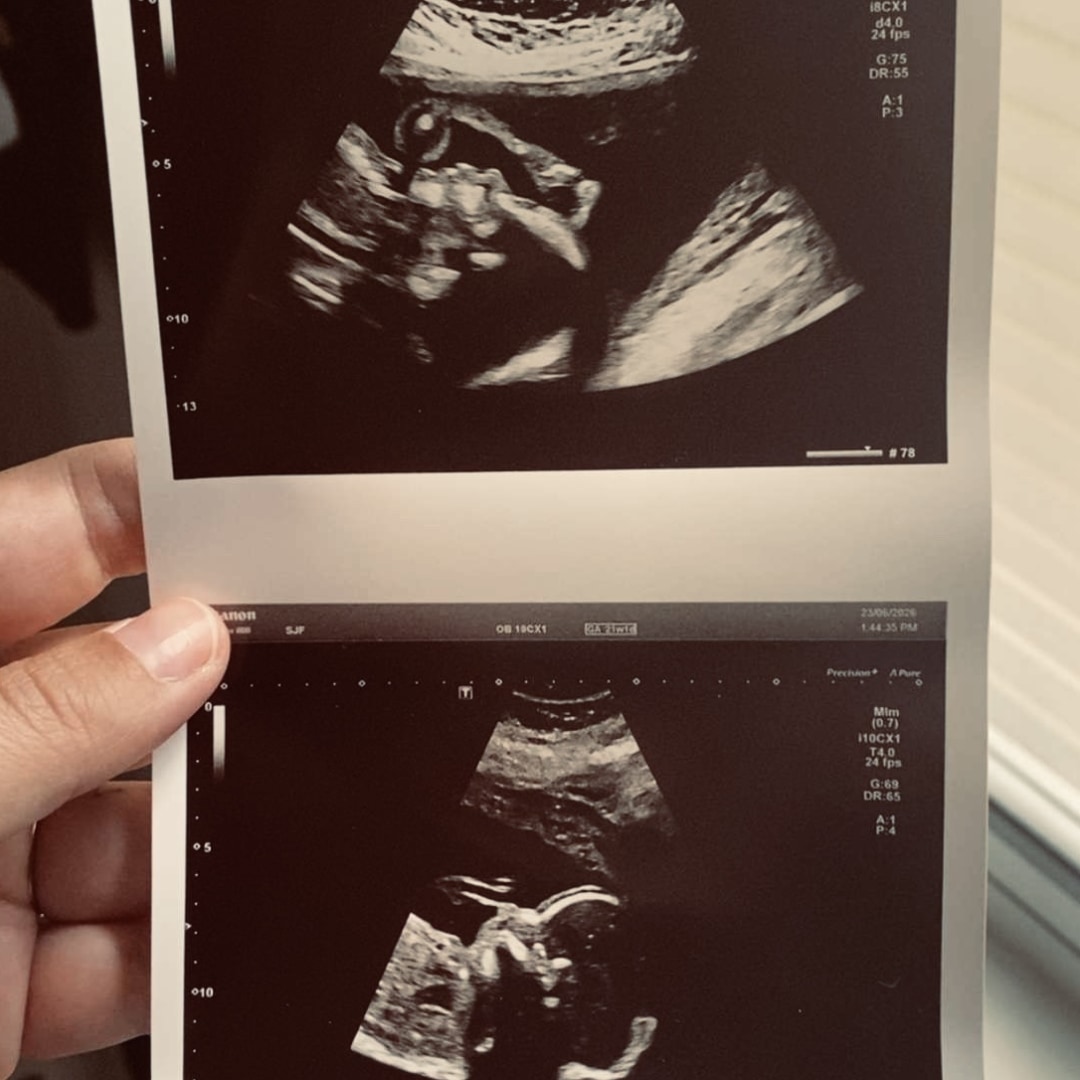 Photo shared by Carrie for their Babylist baby registry.