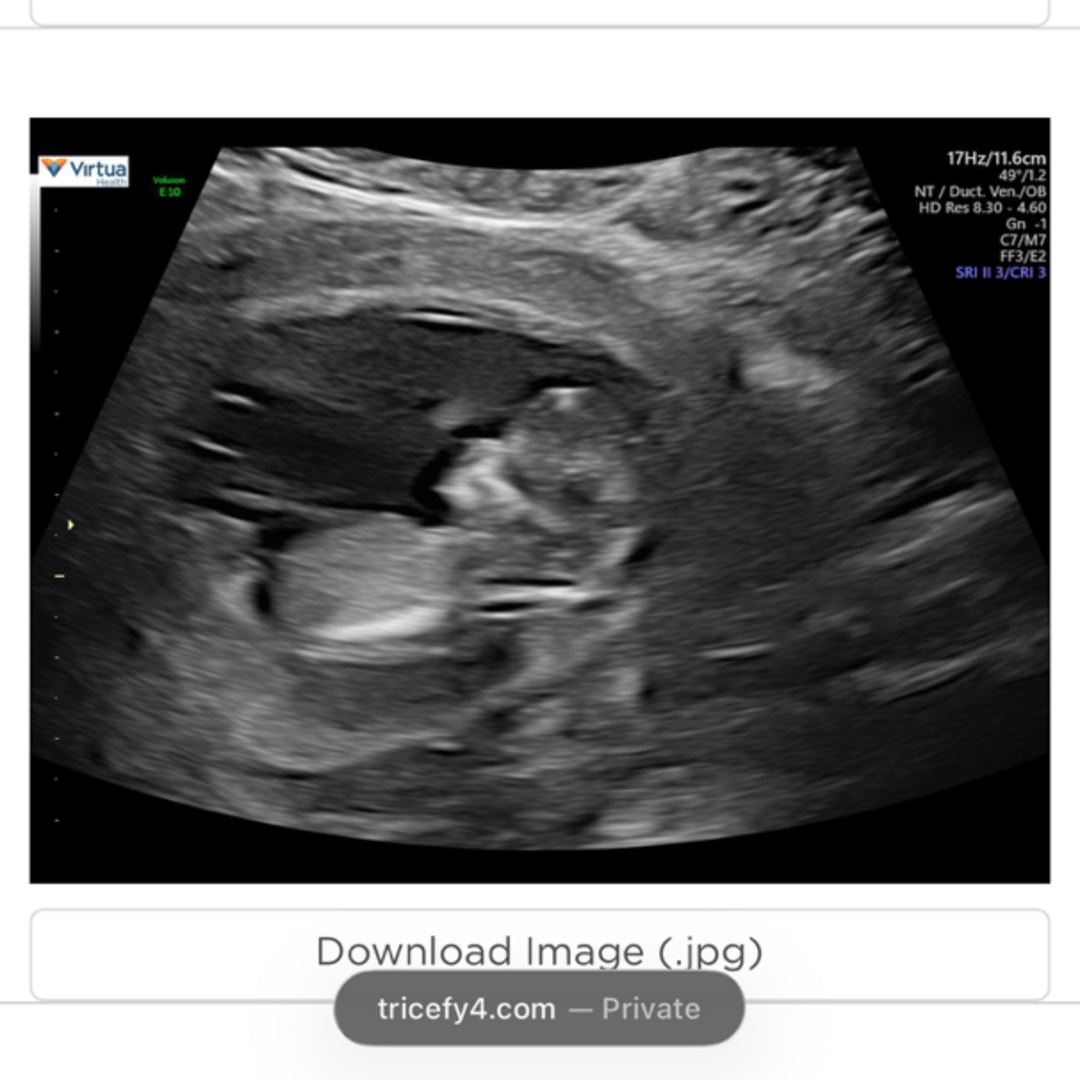 Photo shared by Brandy for their Babylist baby registry.