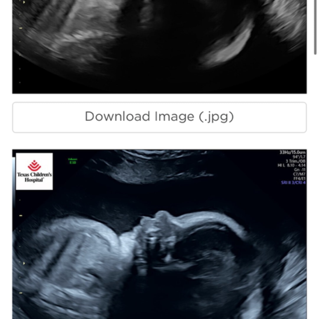 Photo shared by Alyssa for their Babylist baby registry.