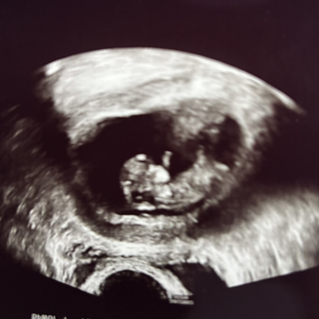 Photo shared by Samantha for their Babylist baby registry.