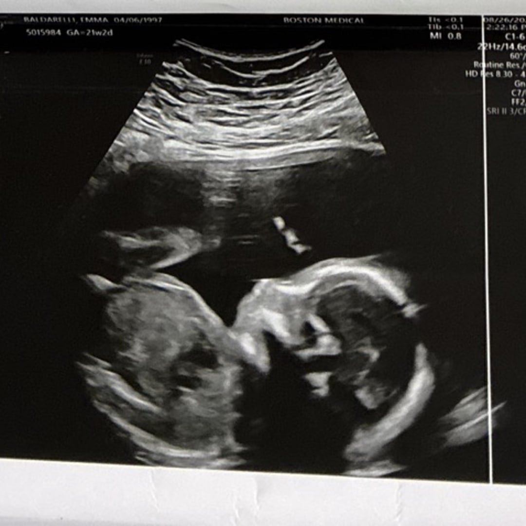 Photo shared by Emma for their Babylist baby registry.