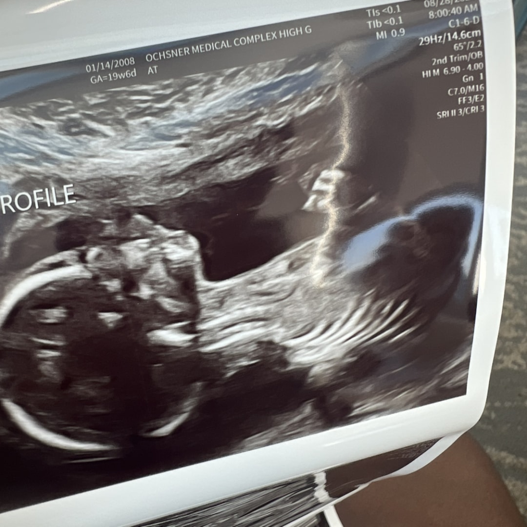 Photo shared by A'miri for their Babylist baby registry.