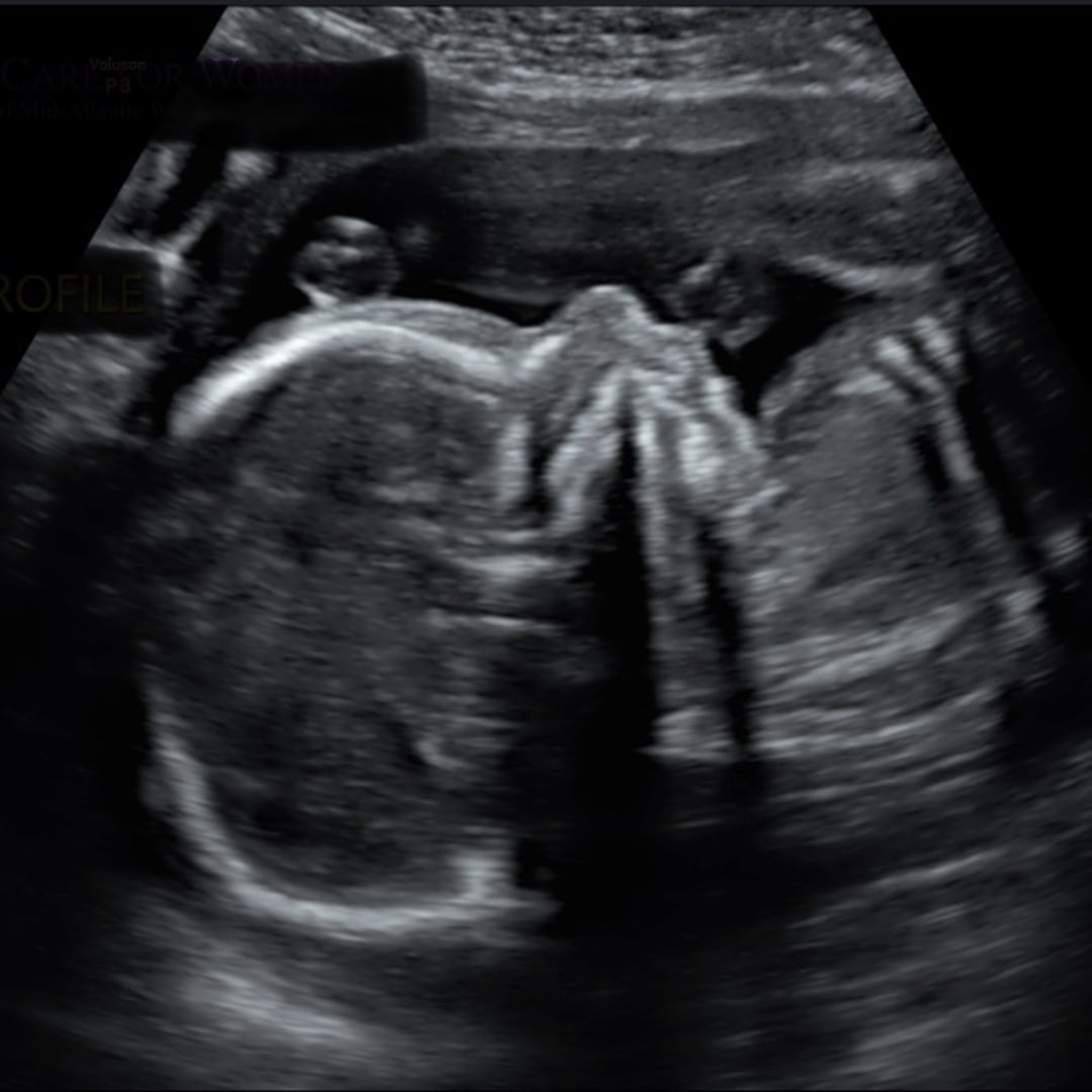 Photo shared by Hannah for their Babylist baby registry.