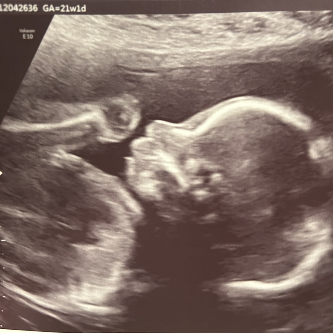Photo shared by Brianna for their Babylist baby registry.