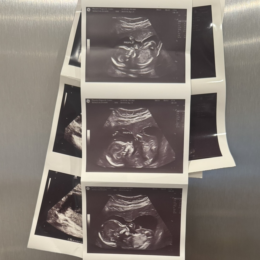 Photo shared by Meliah for their Babylist baby registry.