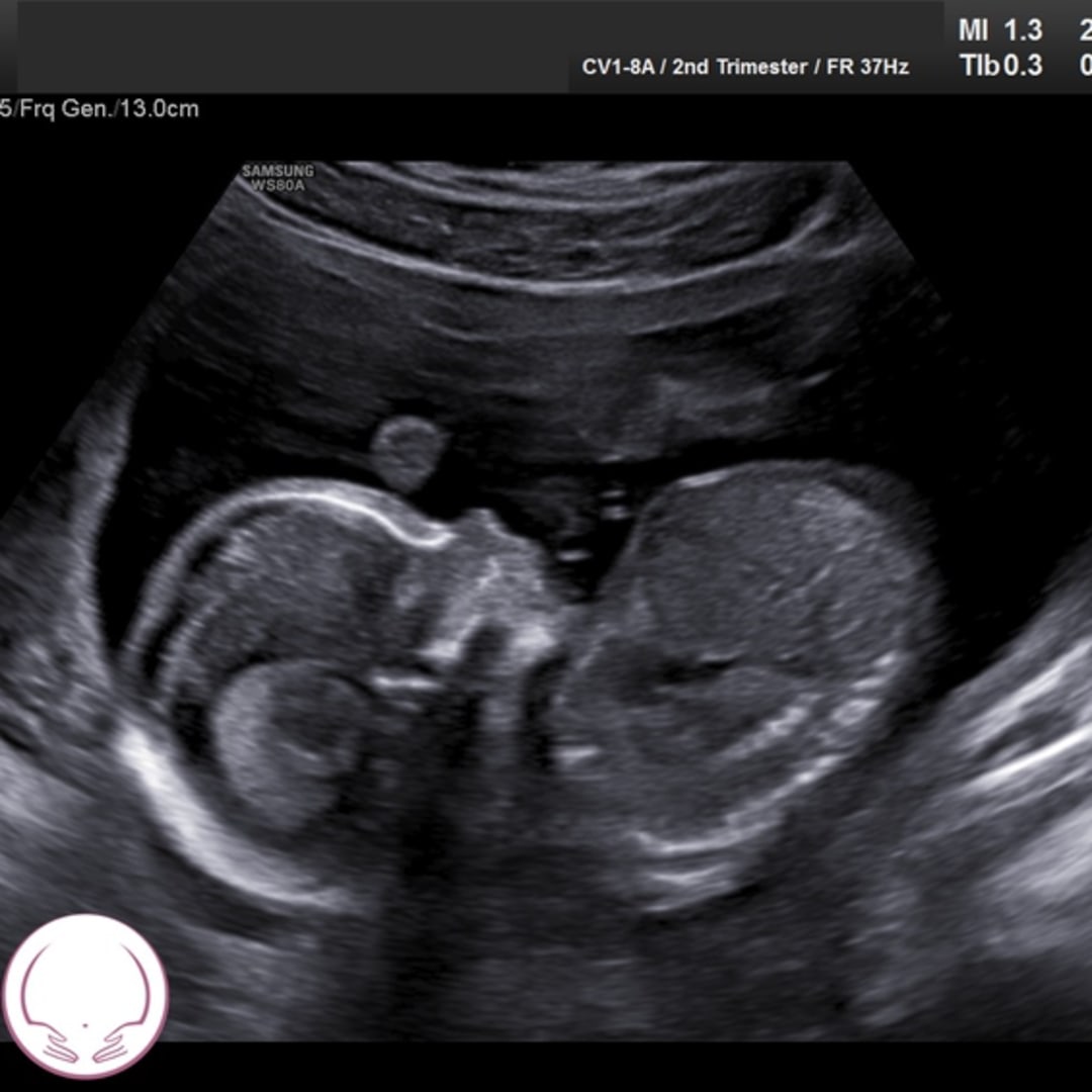 Photo shared by Madison for their Babylist baby registry.