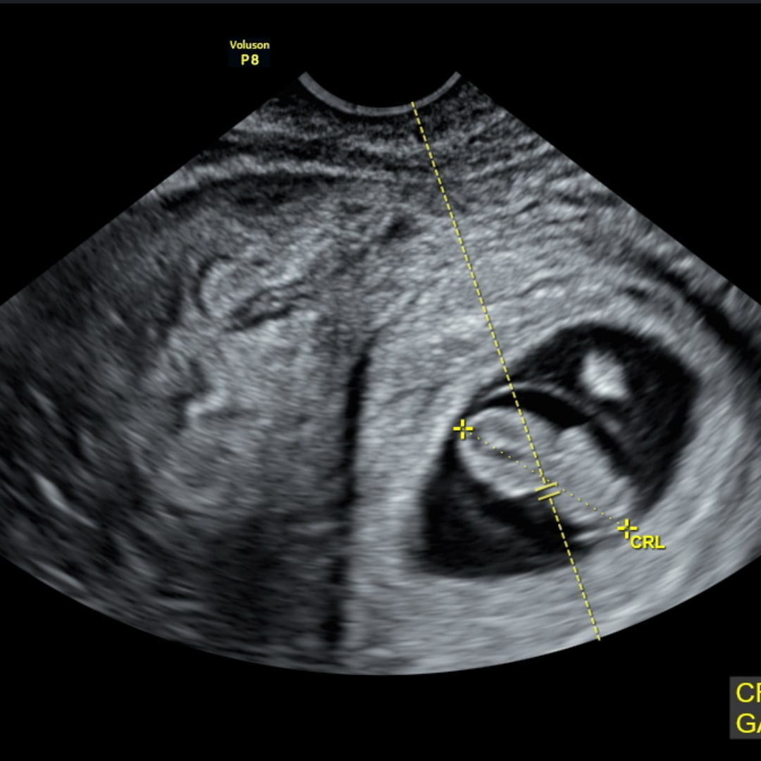 Photo shared by Cassidy for their Babylist baby registry.