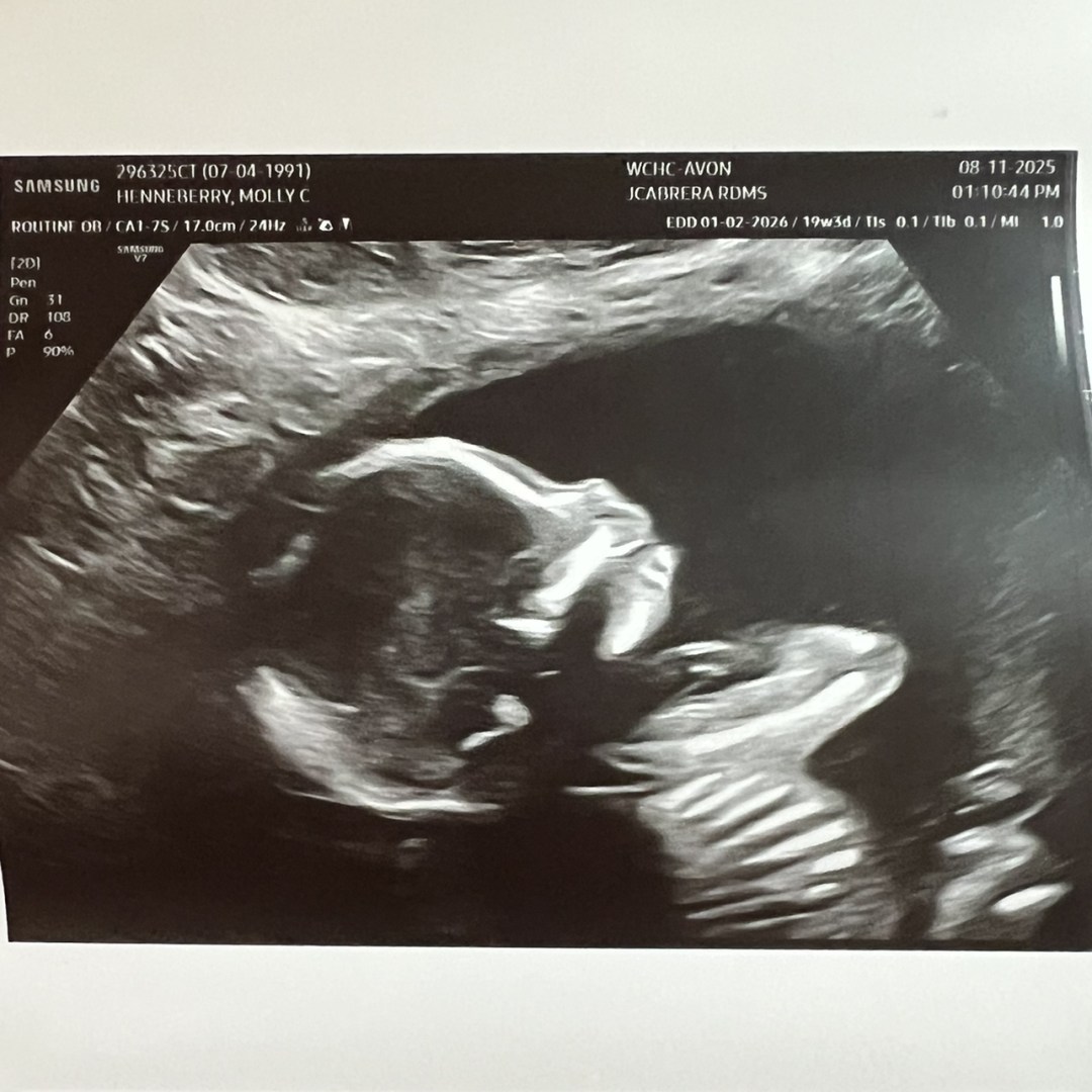 Photo shared by Molly for their Babylist baby registry.