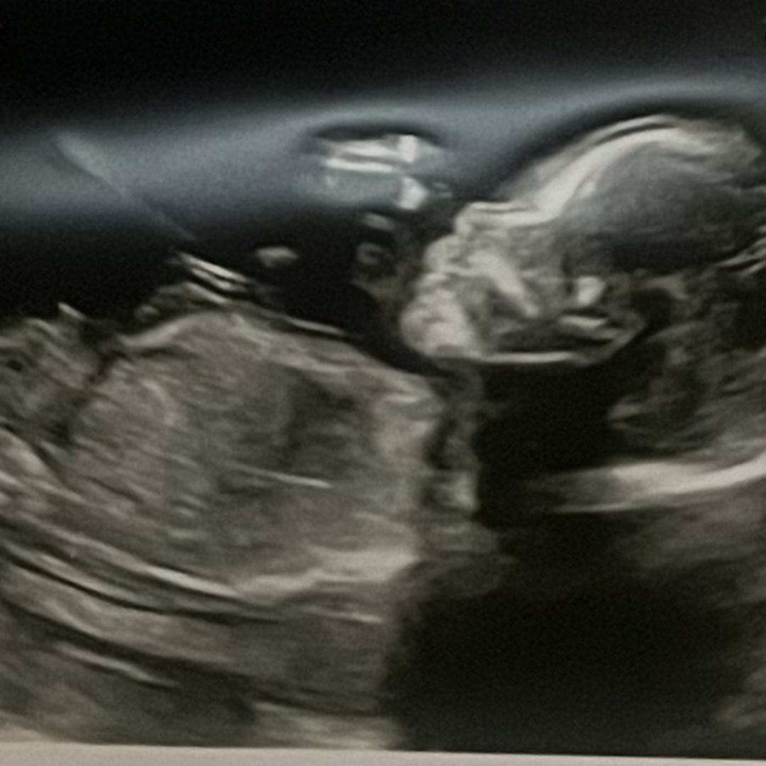 Photo shared by Latrice for their Babylist baby registry.