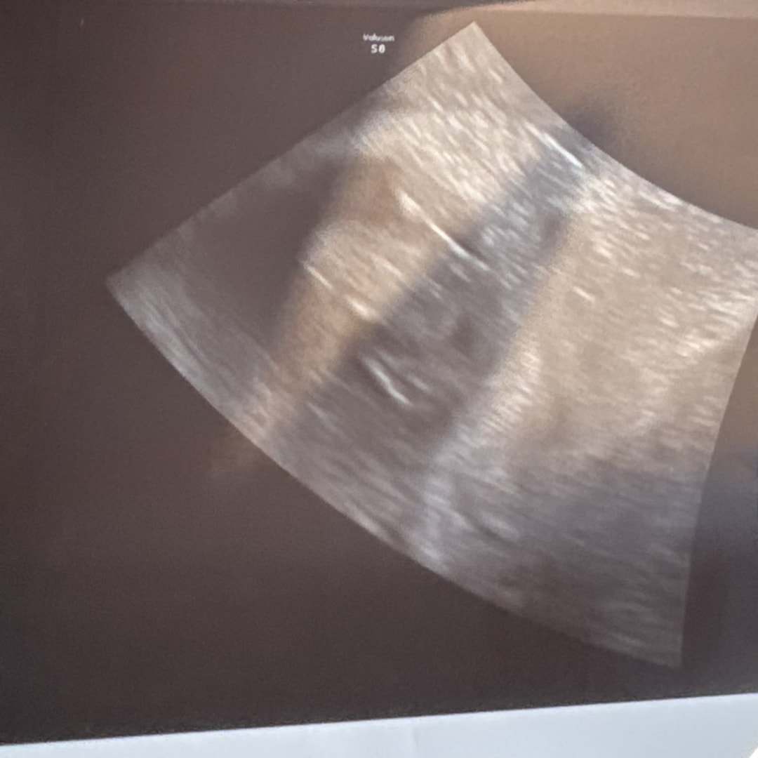 Photo shared by Emilee for their Babylist baby registry.