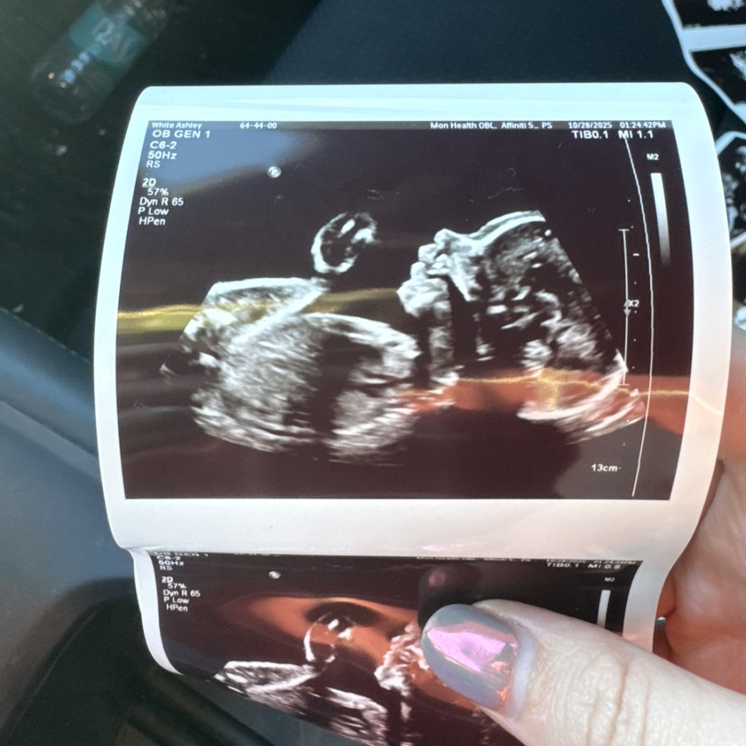 Photo shared by Ashley for their Babylist baby registry.