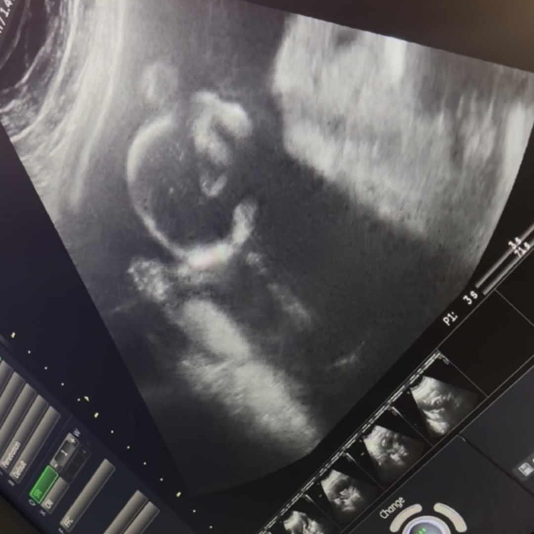 Photo shared by Esperanza for their Babylist baby registry.