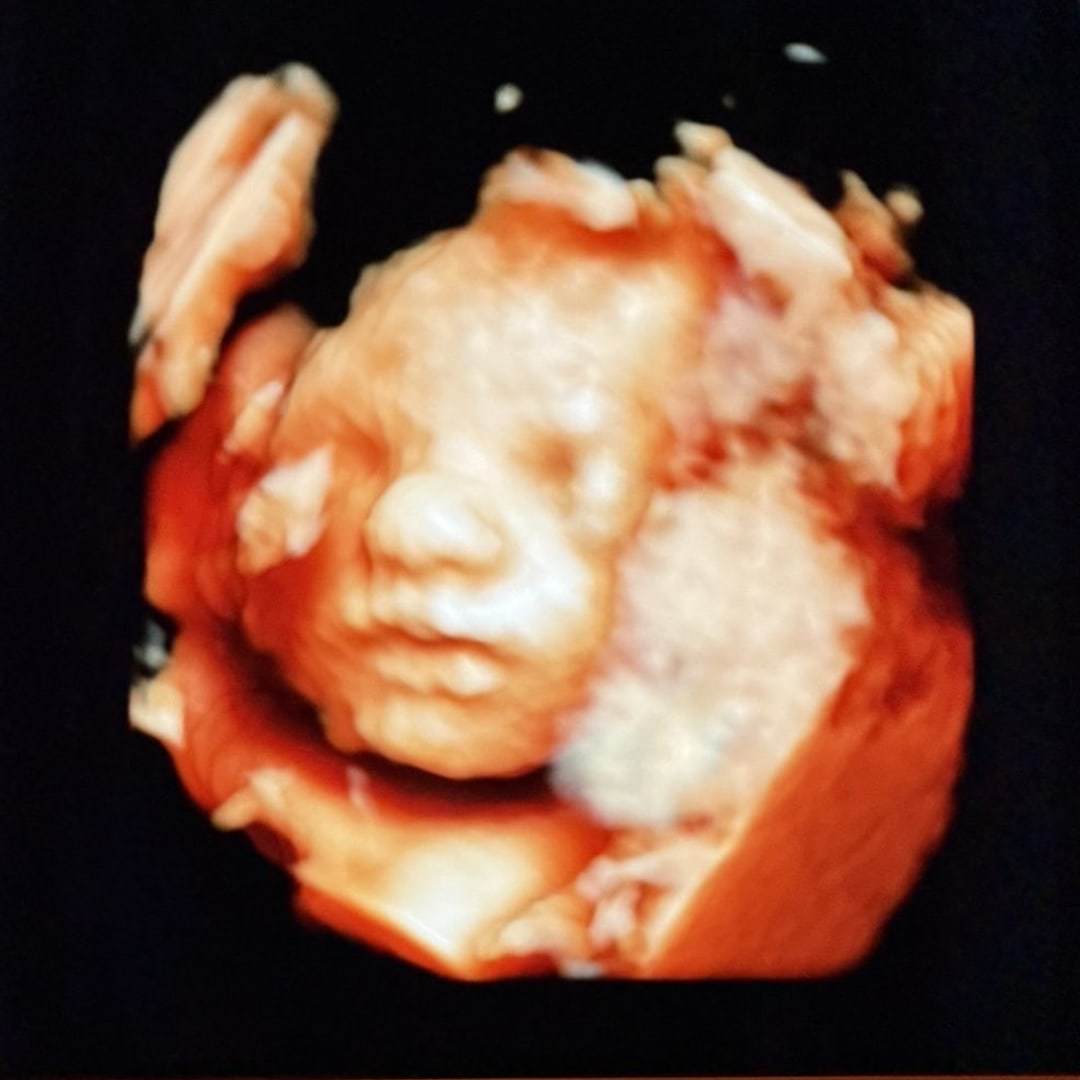 Photo shared by Emma for their Babylist baby registry.