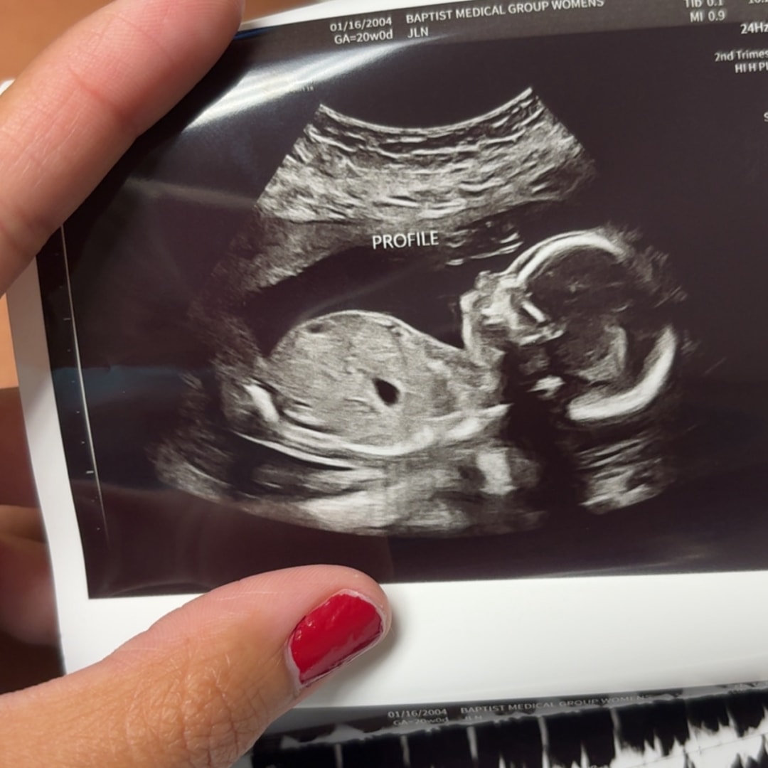 Photo shared by Bailee for their Babylist baby registry.