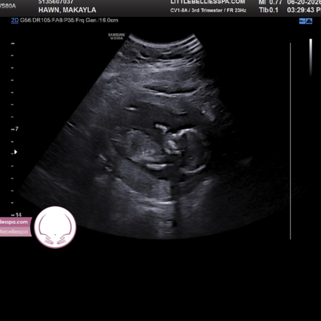 Photo shared by Makayla for their Babylist baby registry.