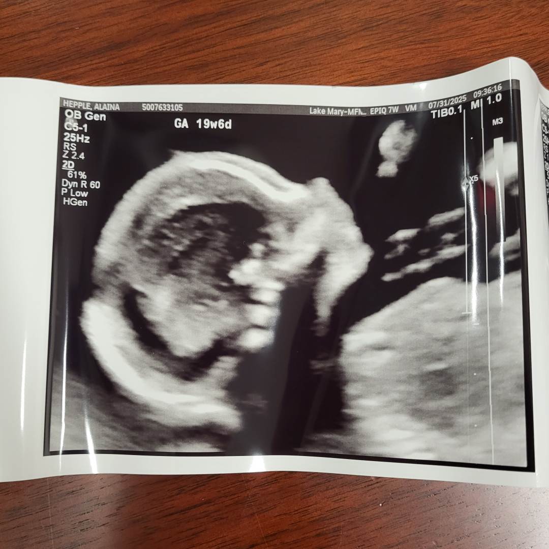 Photo shared by Alaina for their Babylist baby registry.