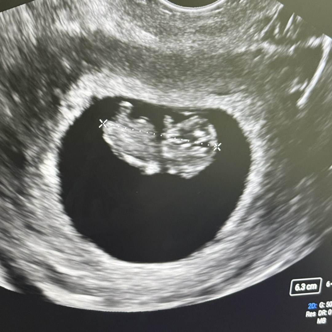 Photo shared by SaMya for their Babylist baby registry.