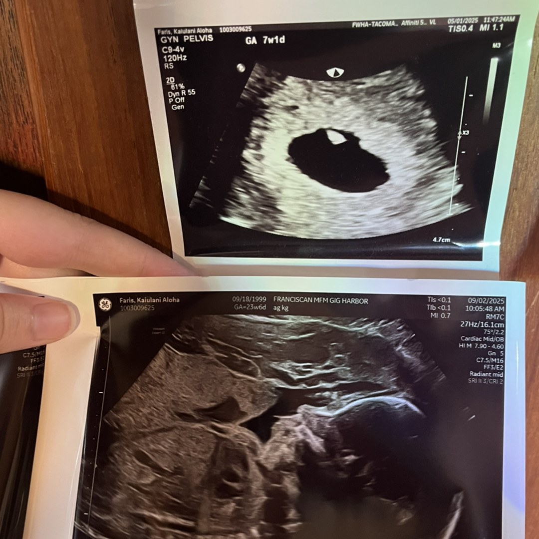 Photo shared by Kaiulani for their Babylist baby registry.