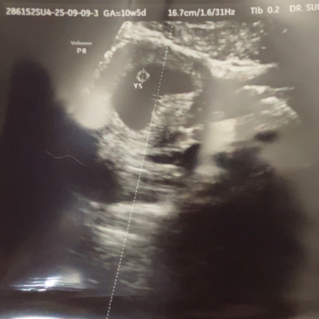 Photo shared by Jamie for their Babylist baby registry.