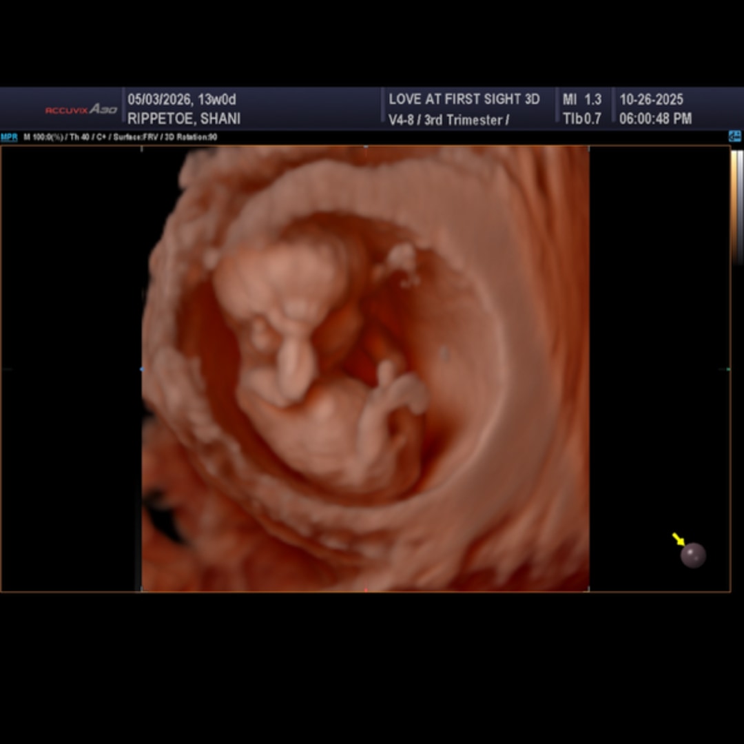 Photo shared by Shani for their Babylist baby registry.