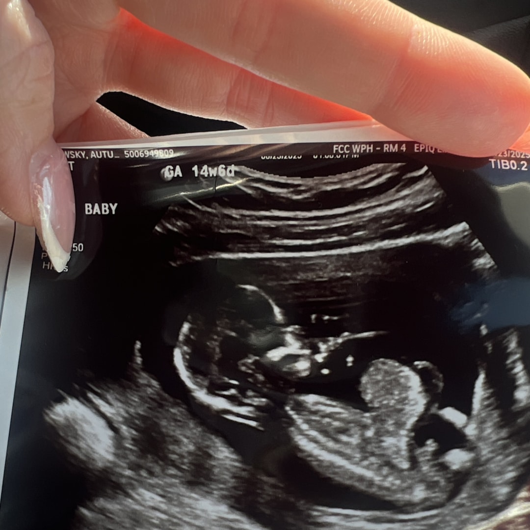 Photo shared by Autumn for their Babylist baby registry.