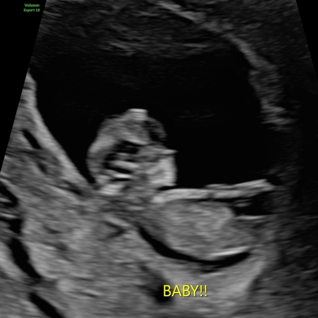 Photo shared by Danielle for their Babylist baby registry.