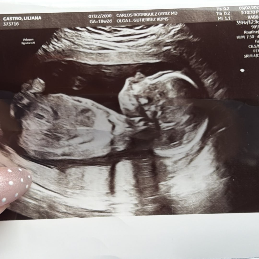 Photo shared by Liliana for their Babylist baby registry.