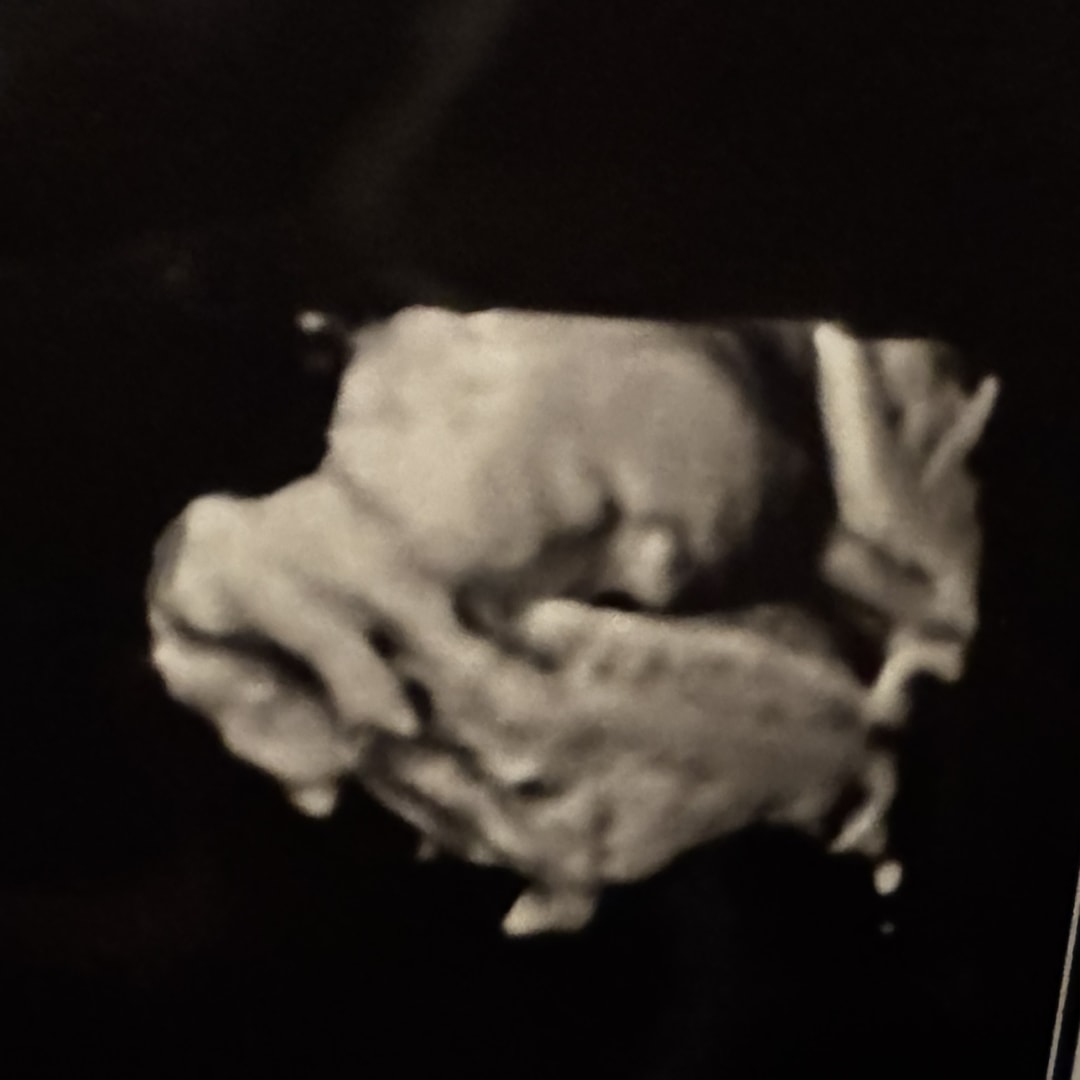 Photo shared by Sierra for their Babylist baby registry.