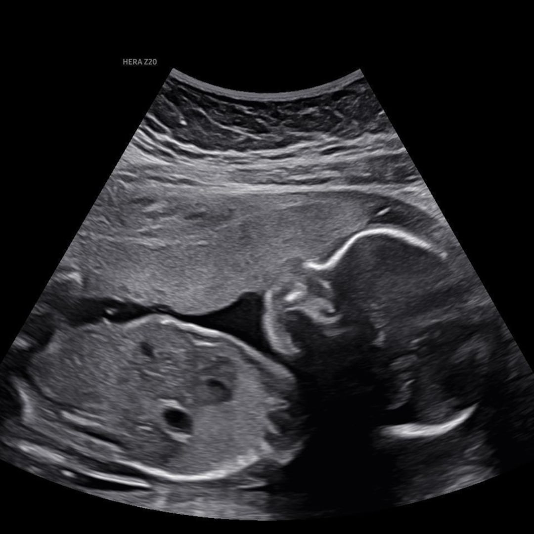 Photo shared by Francine for their Babylist baby registry.