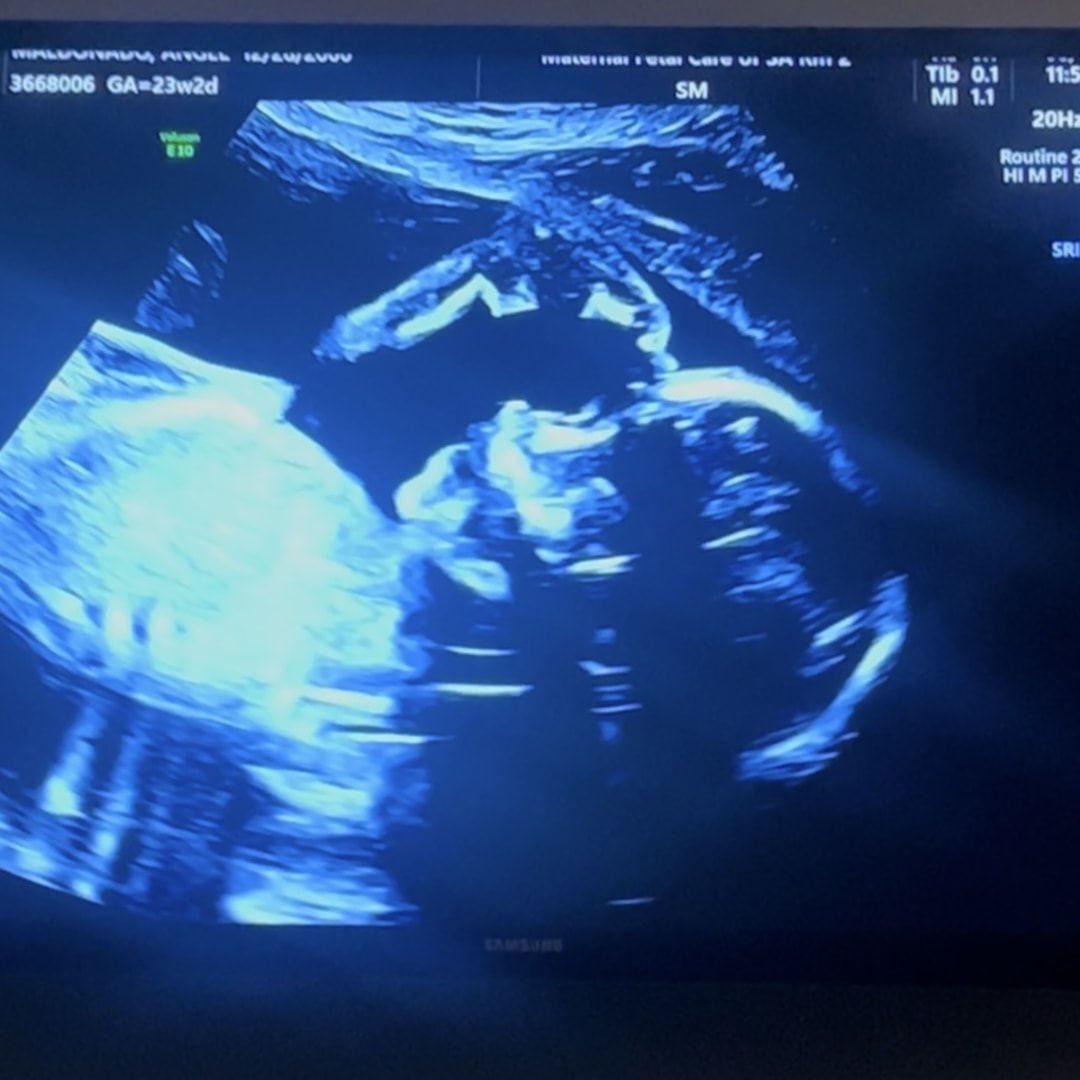Photo shared by Angel for their Babylist baby registry.