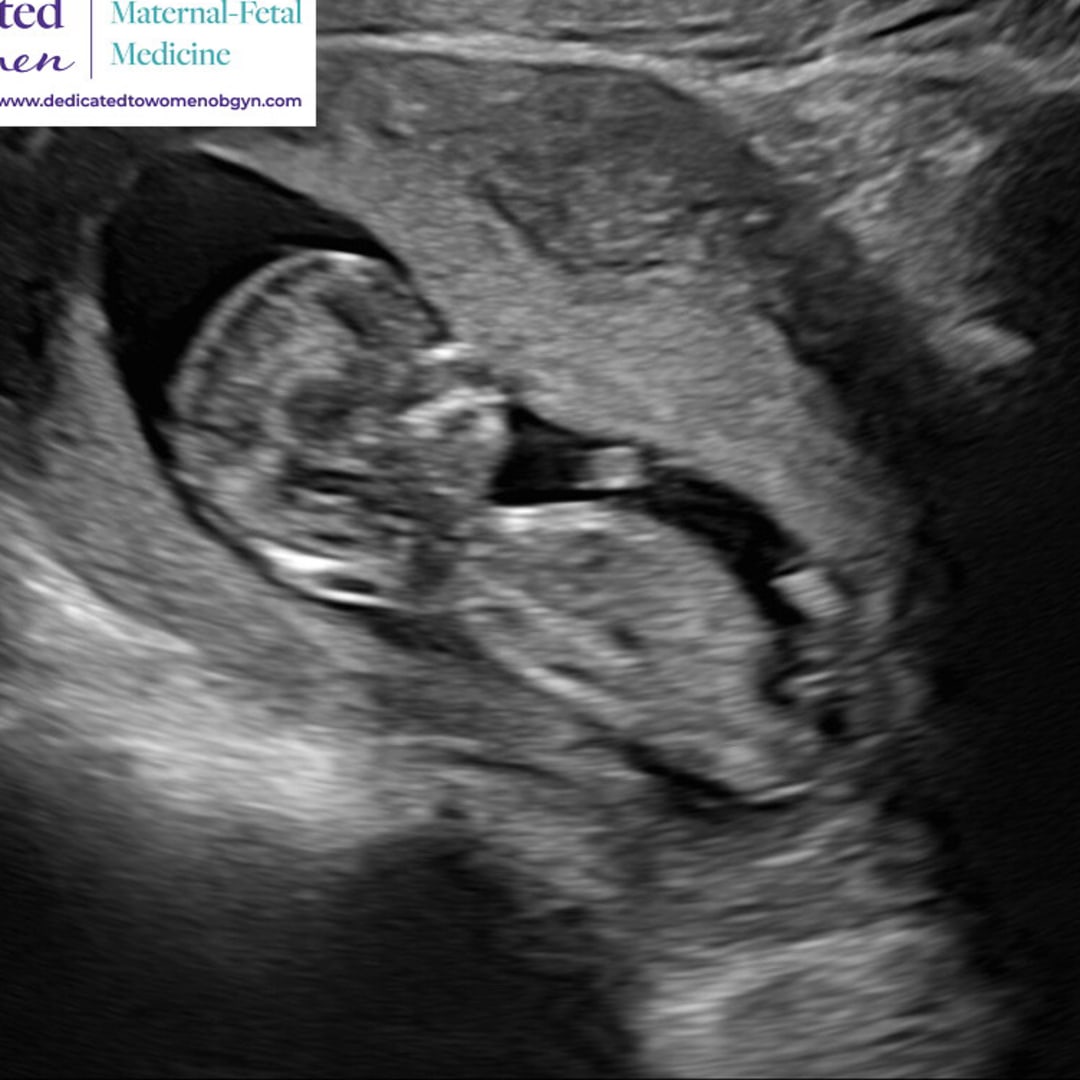 Photo shared by Alisha for their Babylist baby registry.