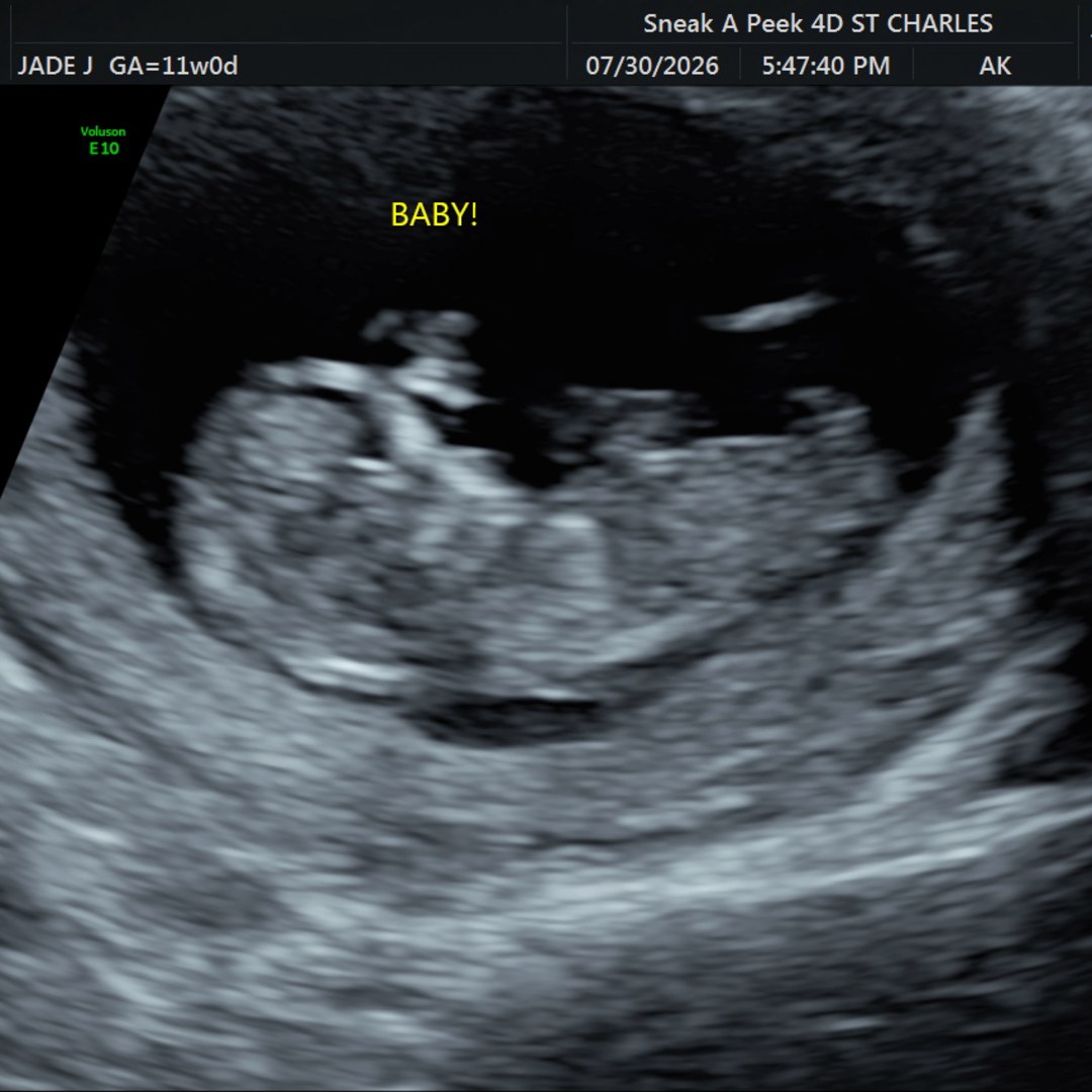 Photo shared by Jade for their Babylist baby registry.