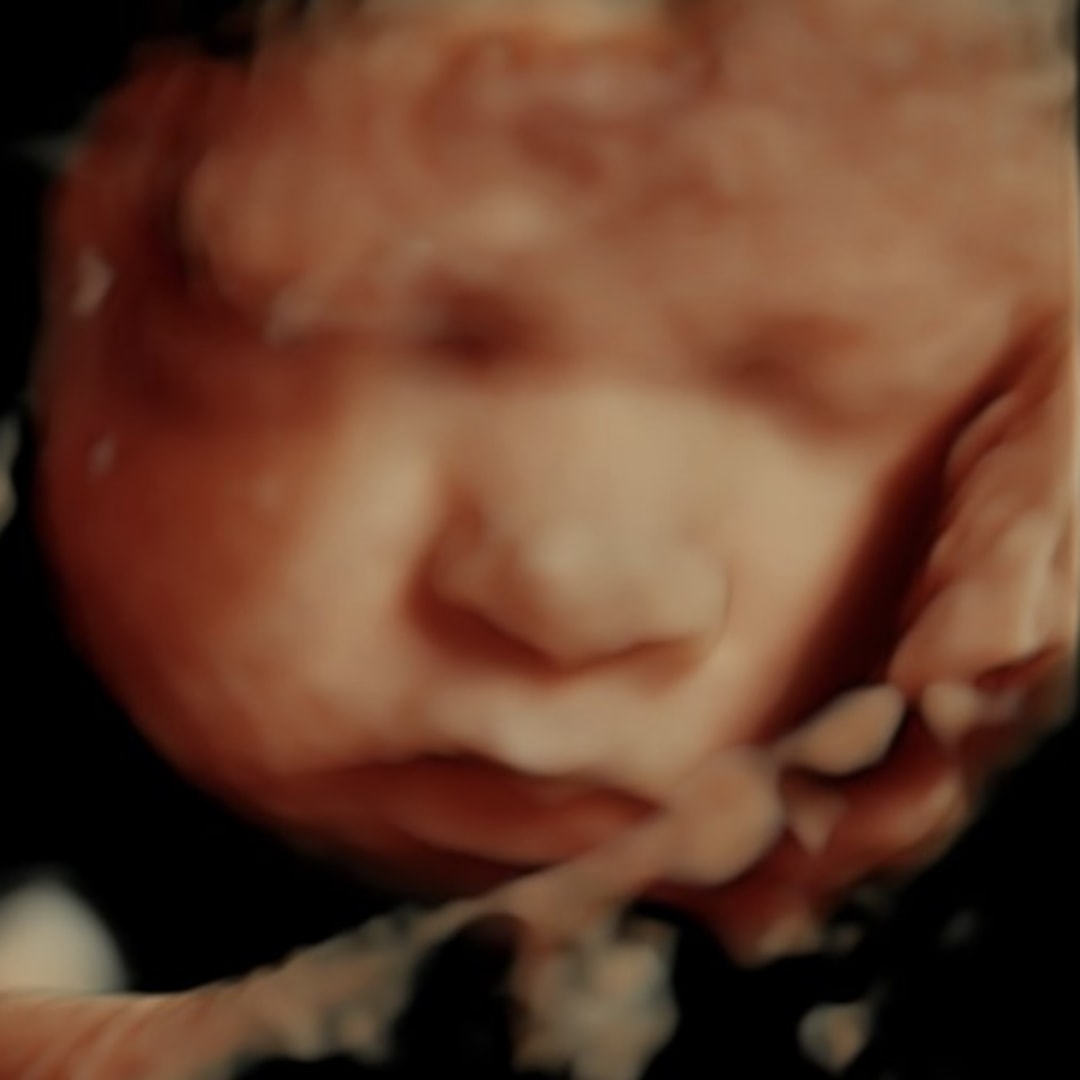 Photo shared by Cherice for their Babylist baby registry.