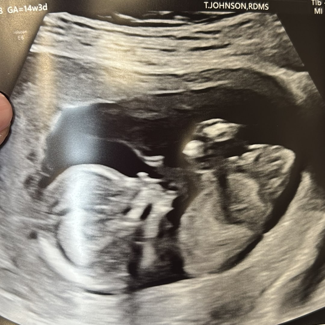 Photo shared by Patton for their Babylist baby registry.