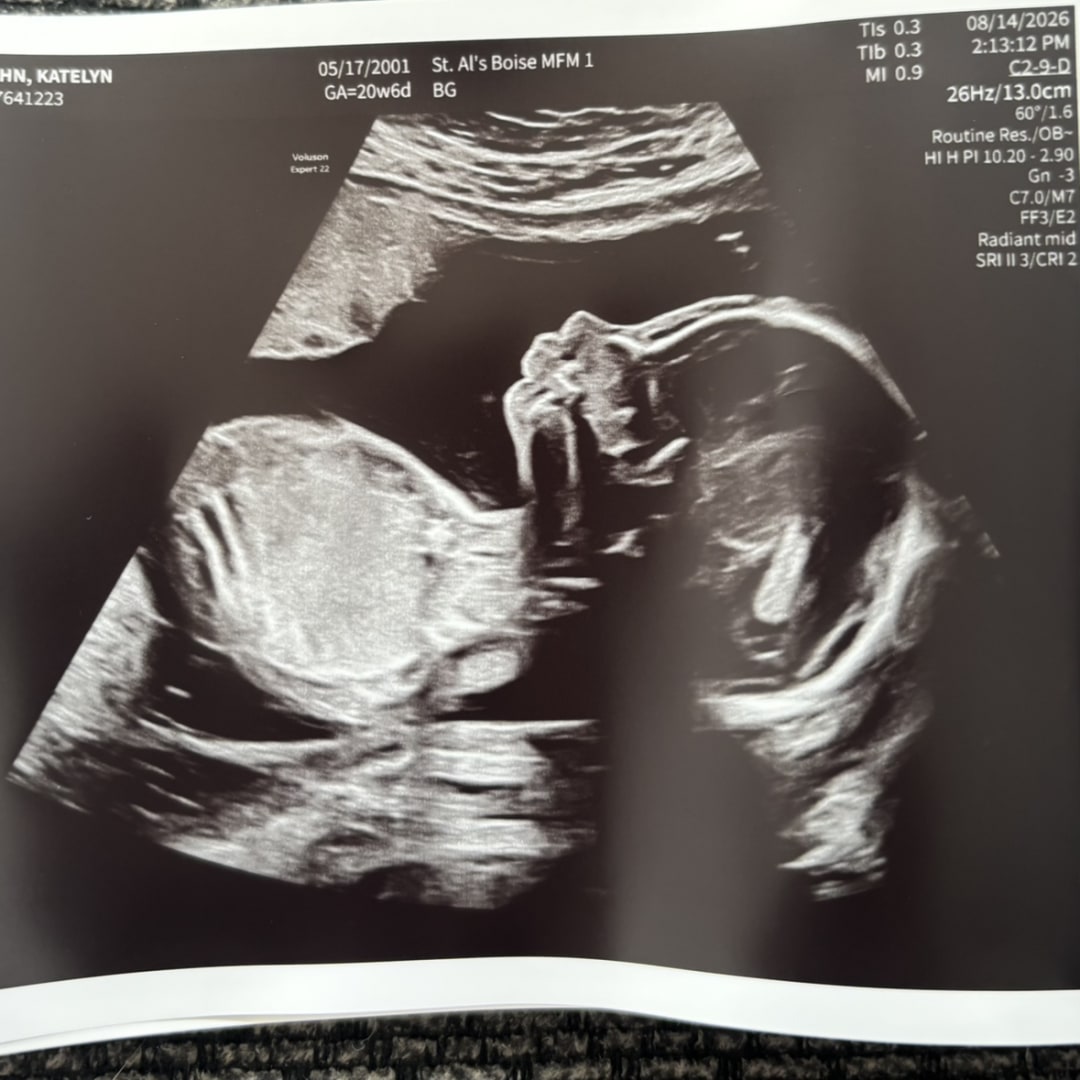 Photo shared by Katelyn for their Babylist baby registry.