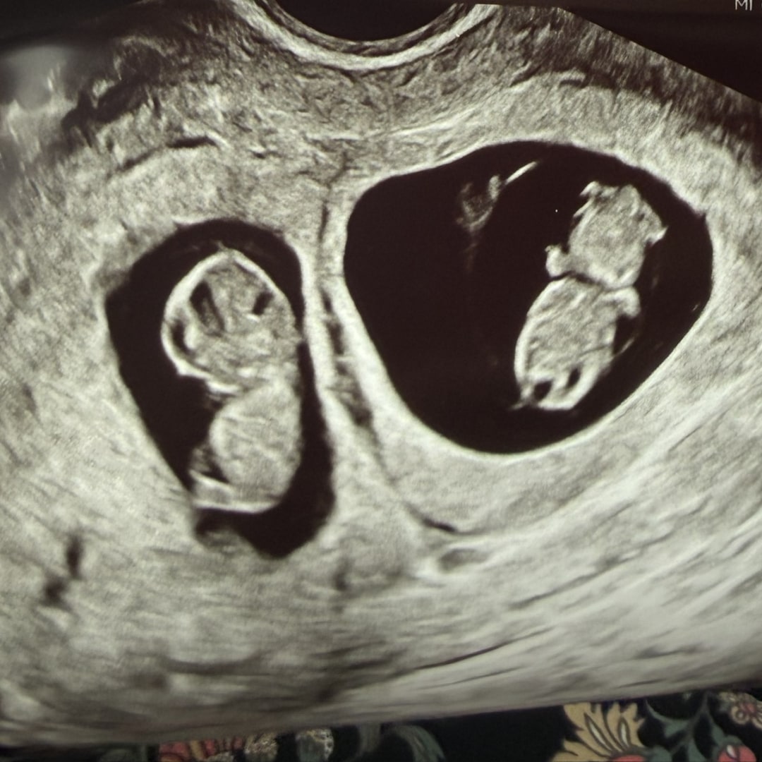 Photo shared by Shannon for their Babylist baby registry.