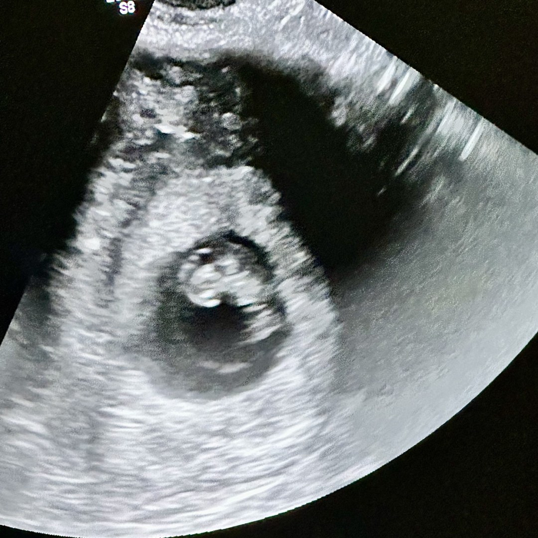 Photo shared by Kayla for their Babylist baby registry.