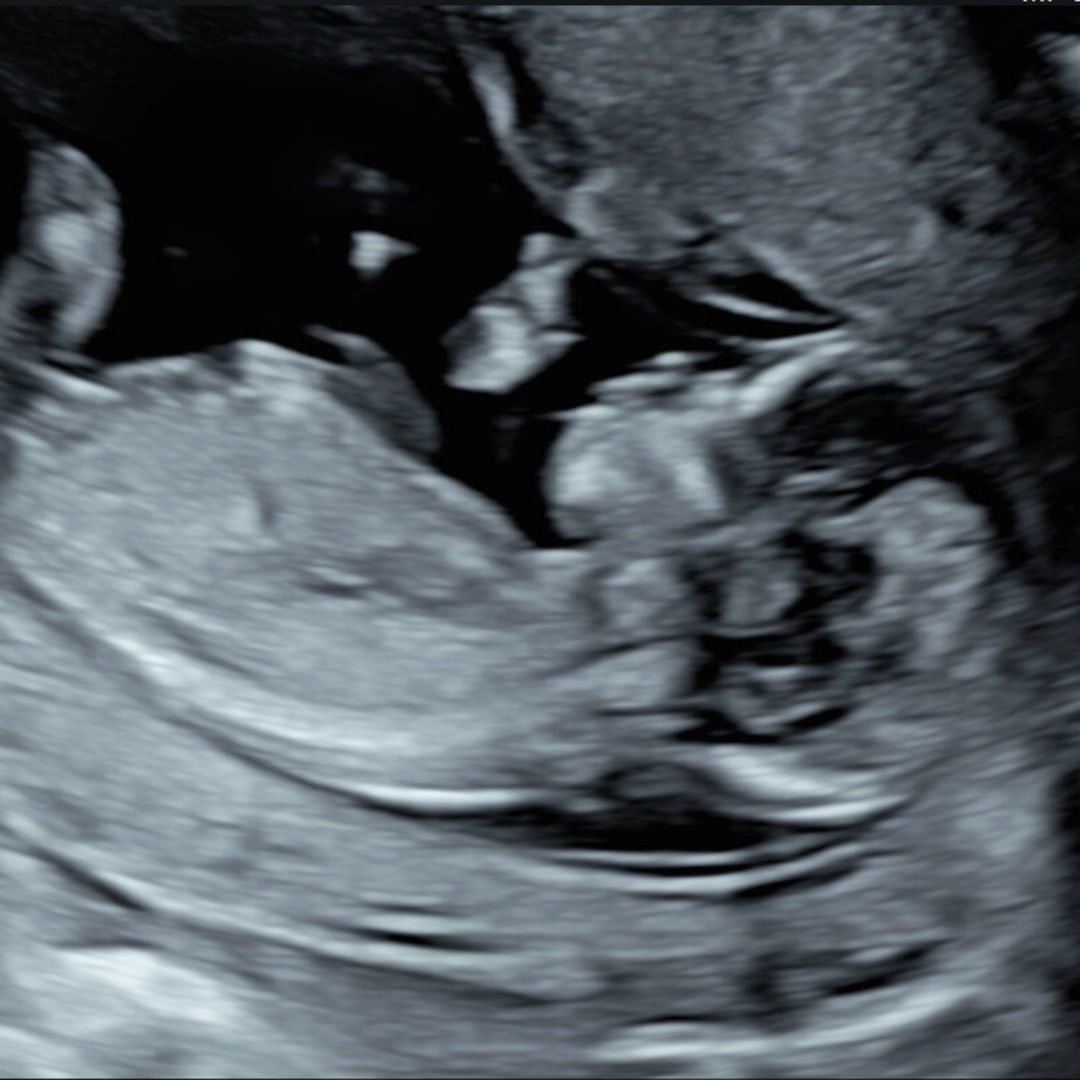 Photo shared by Eloisa for their Babylist baby registry.