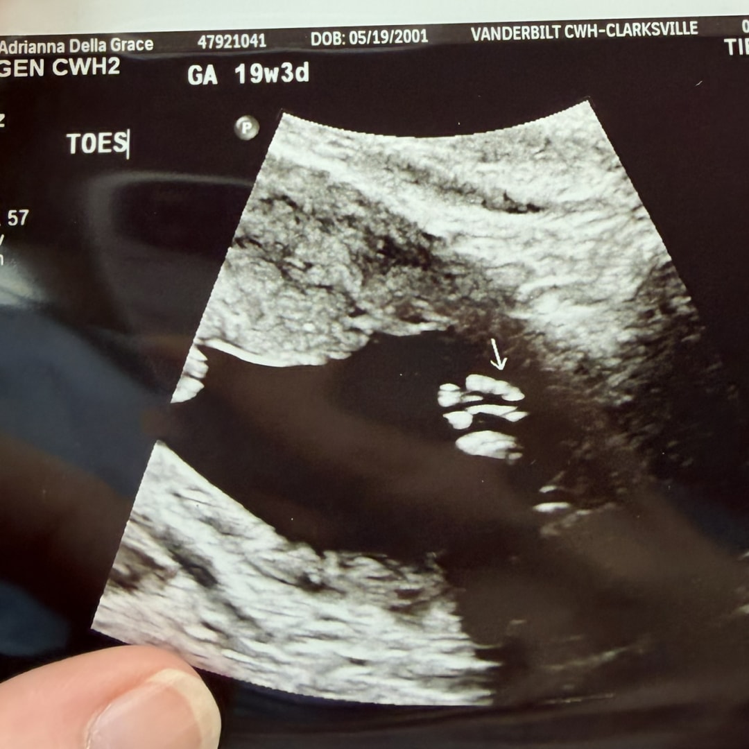 Photo shared by Grace for their Babylist baby registry.