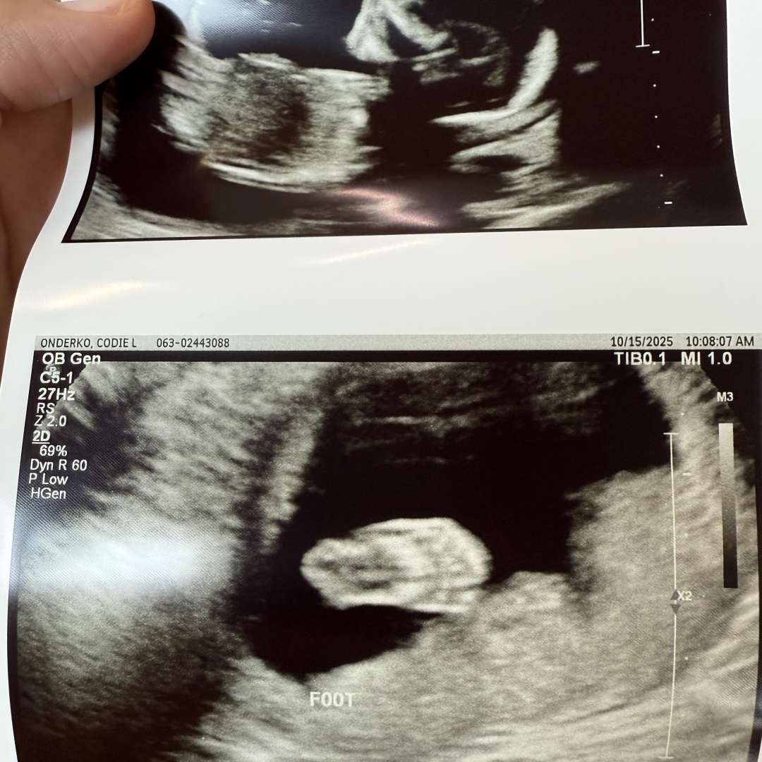 Photo shared by Codie for their Babylist baby registry.