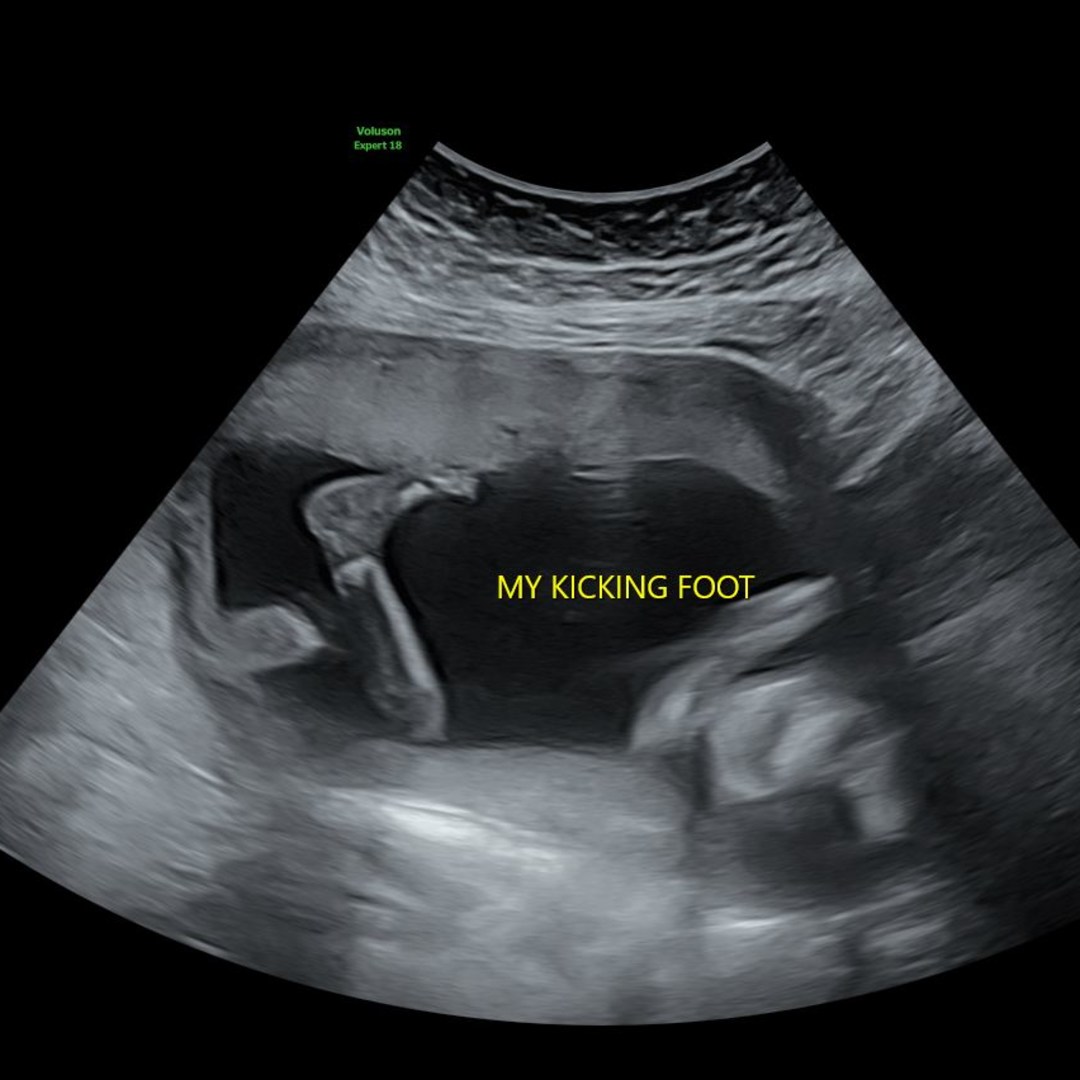 Photo shared by Damyan for their Babylist baby registry.