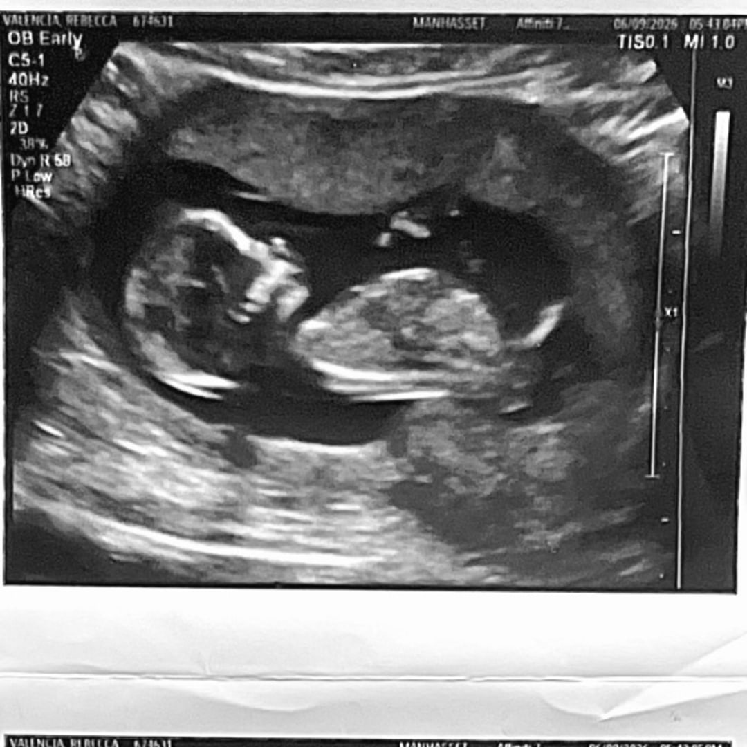 Photo shared by Bex for their Babylist baby registry.