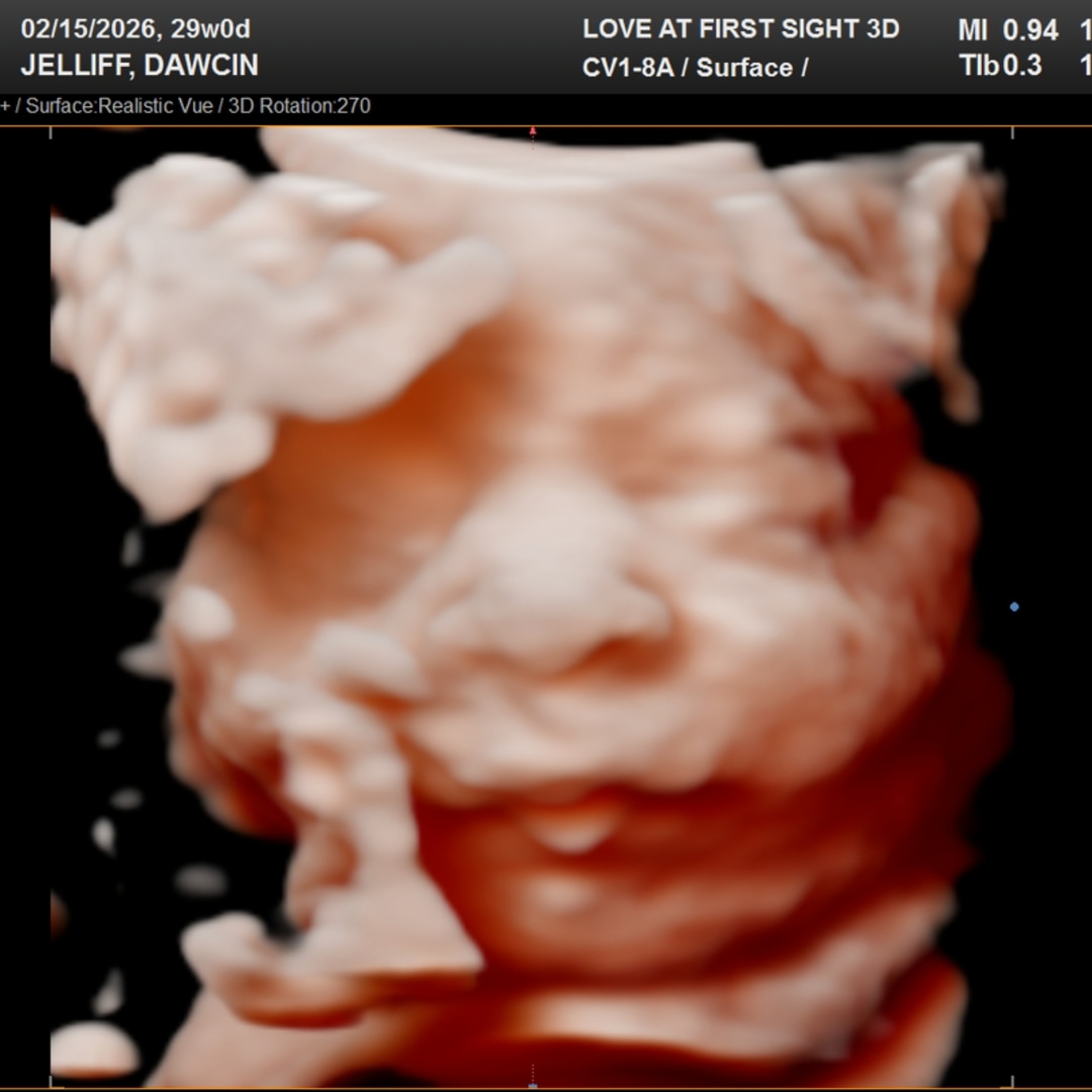 Photo shared by Dawcin for their Babylist baby registry.