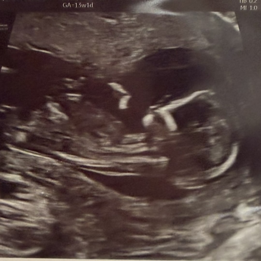 Photo shared by Emanuela for their Babylist baby registry.