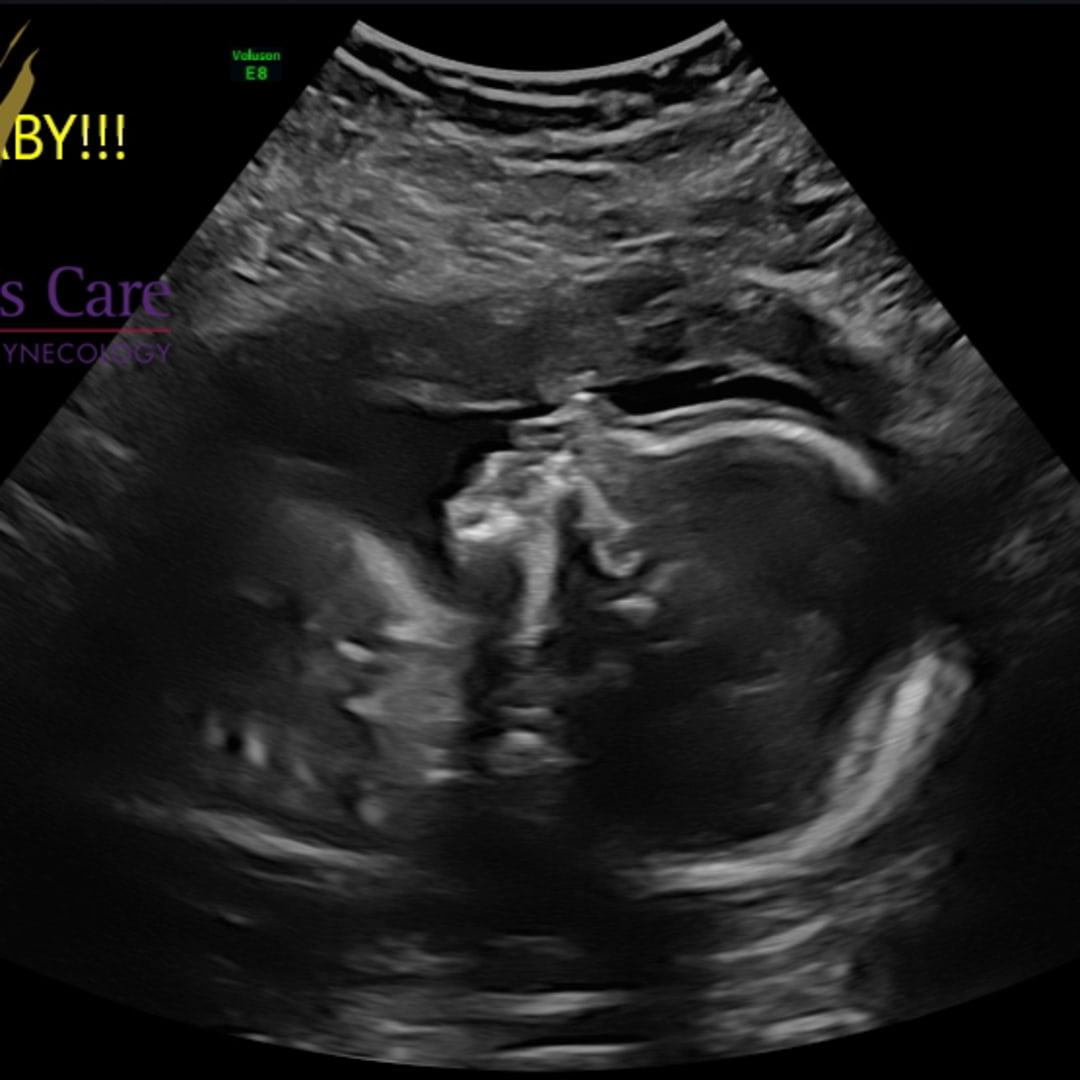 Photo shared by Devon for their Babylist baby registry.