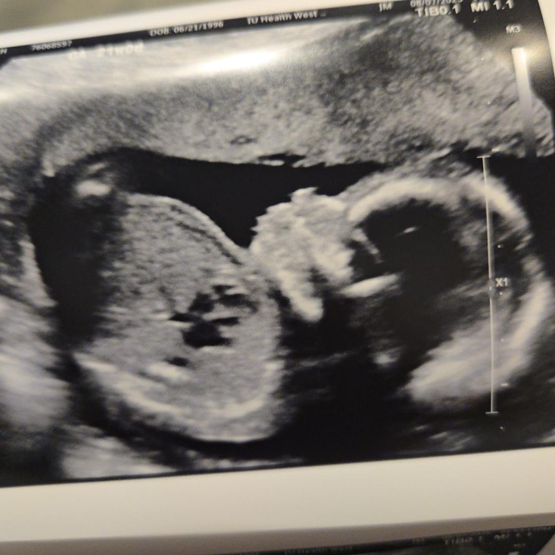 Photo shared by Hannah for their Babylist baby registry.