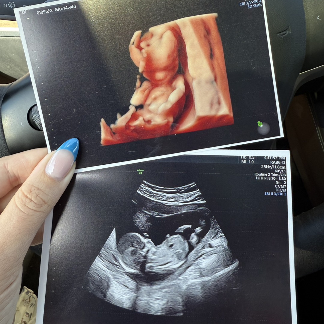 Photo shared by Jackie for their Babylist baby registry.